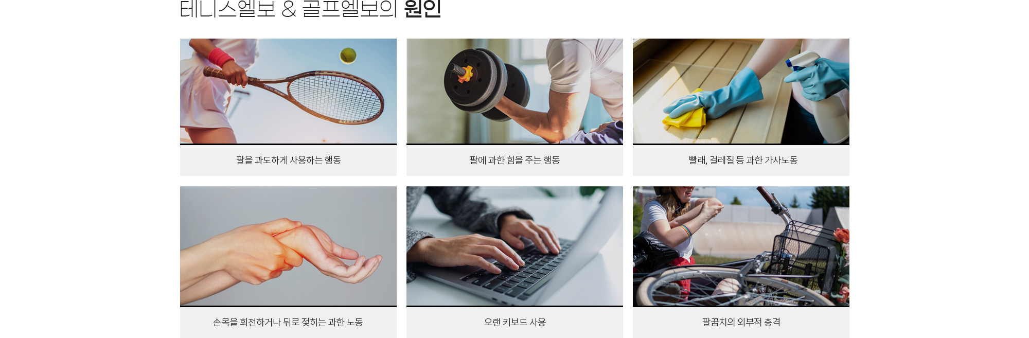 팔꿈치 상세 이미지 3