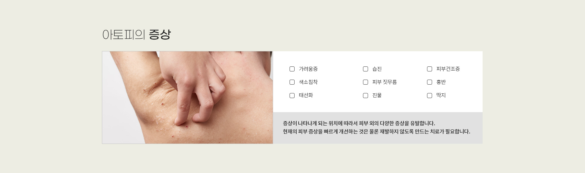 아토피·여드름·습진 상세 이미지 2
