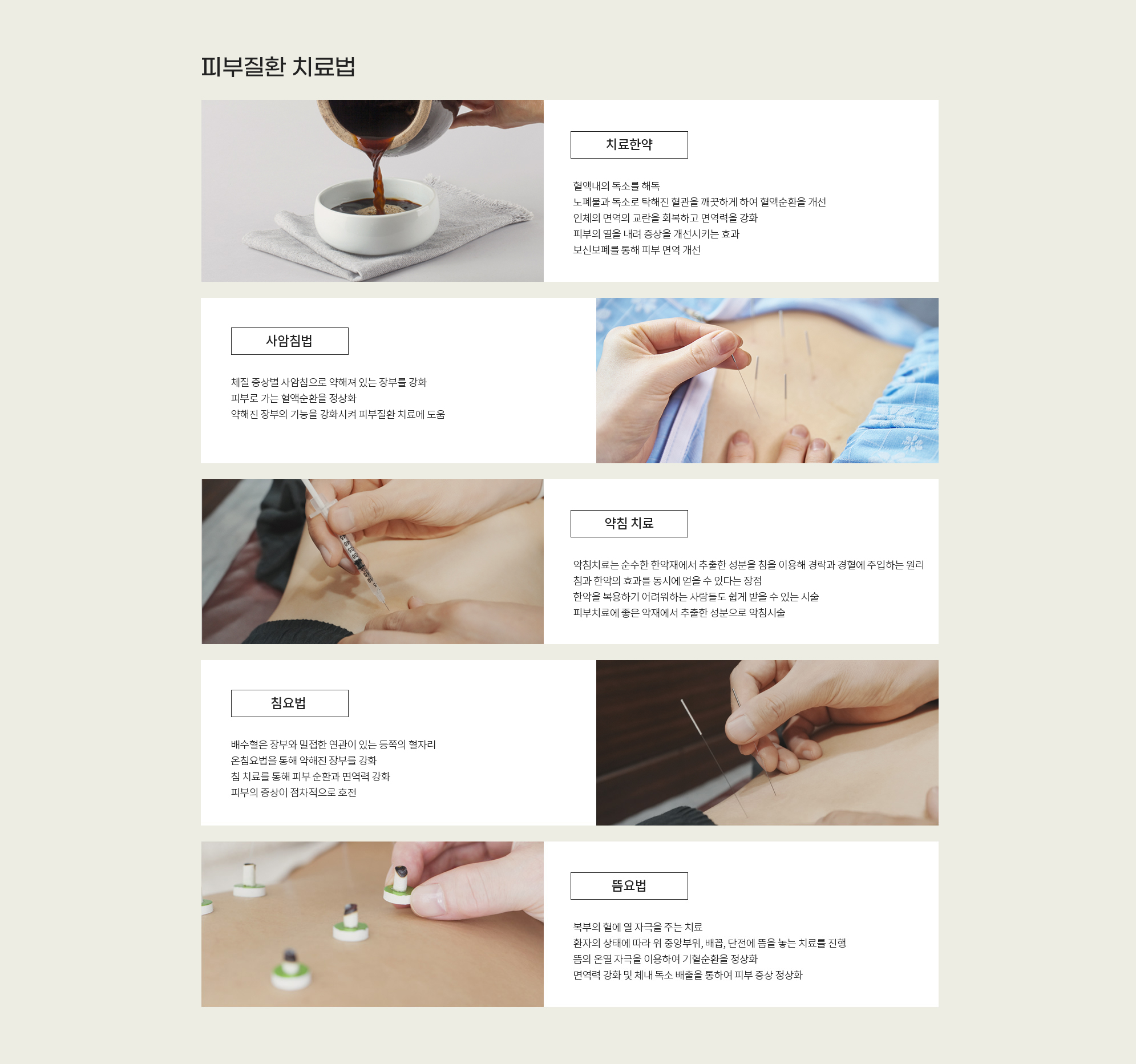 아토피·여드름·습진 상세 이미지 10