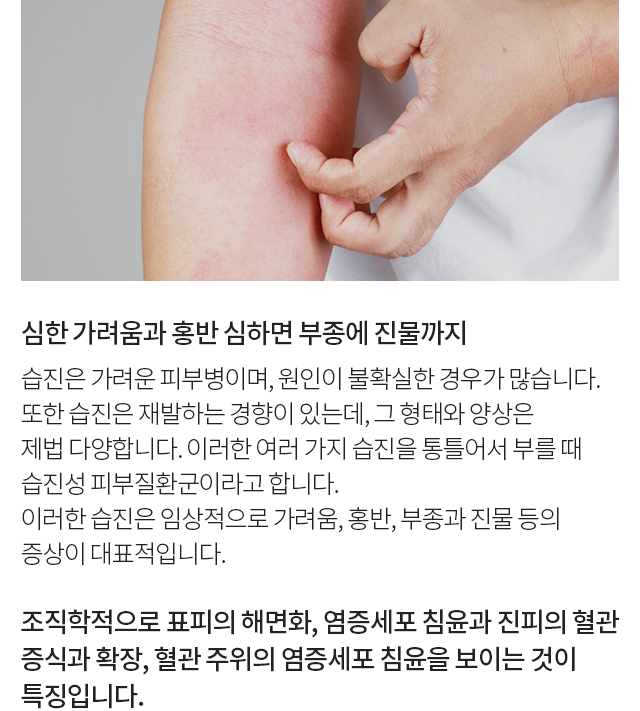 피부질환 모바일 상세 이미지 7